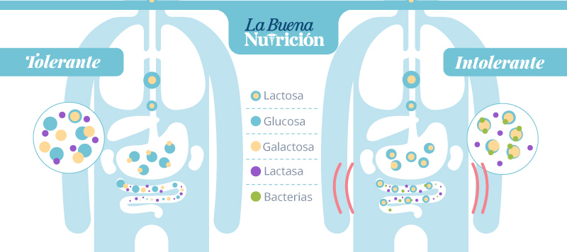 Por qué soy intolerante a la lactosa
